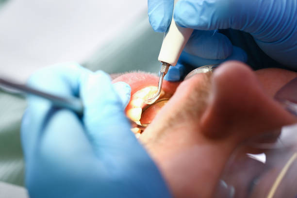 Best Pediatric Emergency Dentist in Cortland, NY